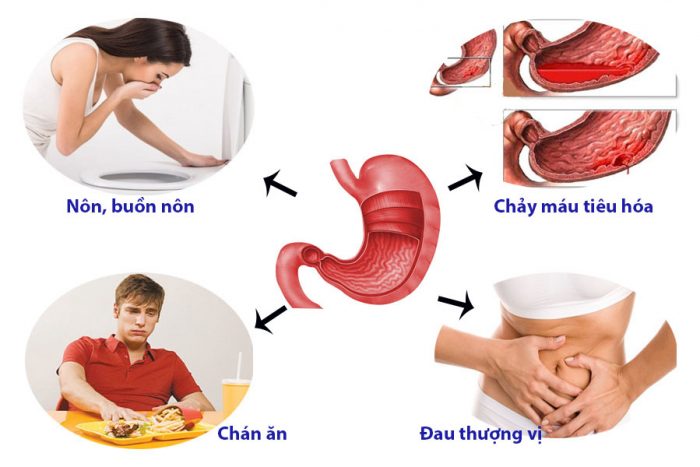 Giảm đau dạ dày, trào ngược, cải thiện tiêu hóa, bảo vệ niêm mạc dạ dày.